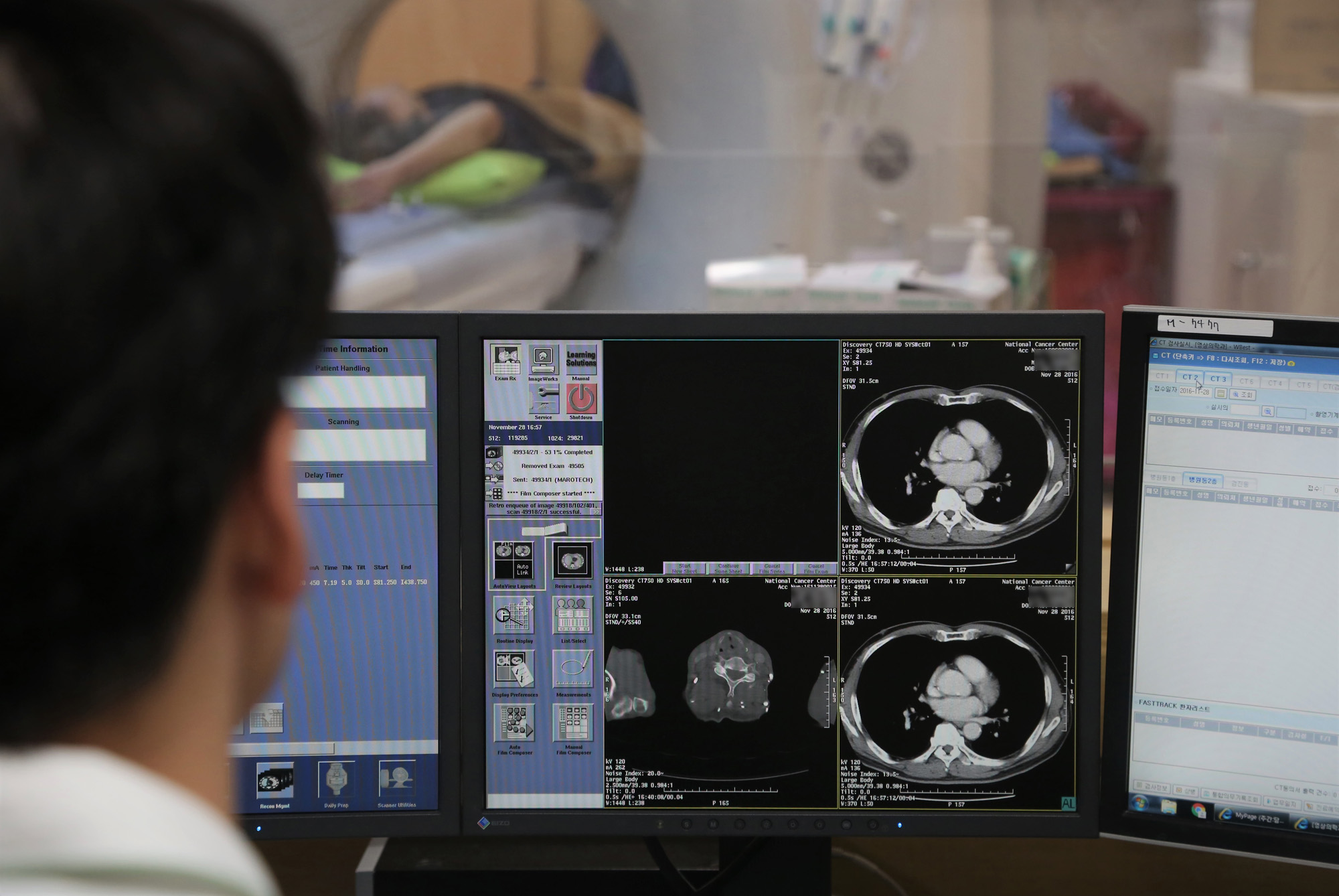 의학;명의;복부촬영;췌장암