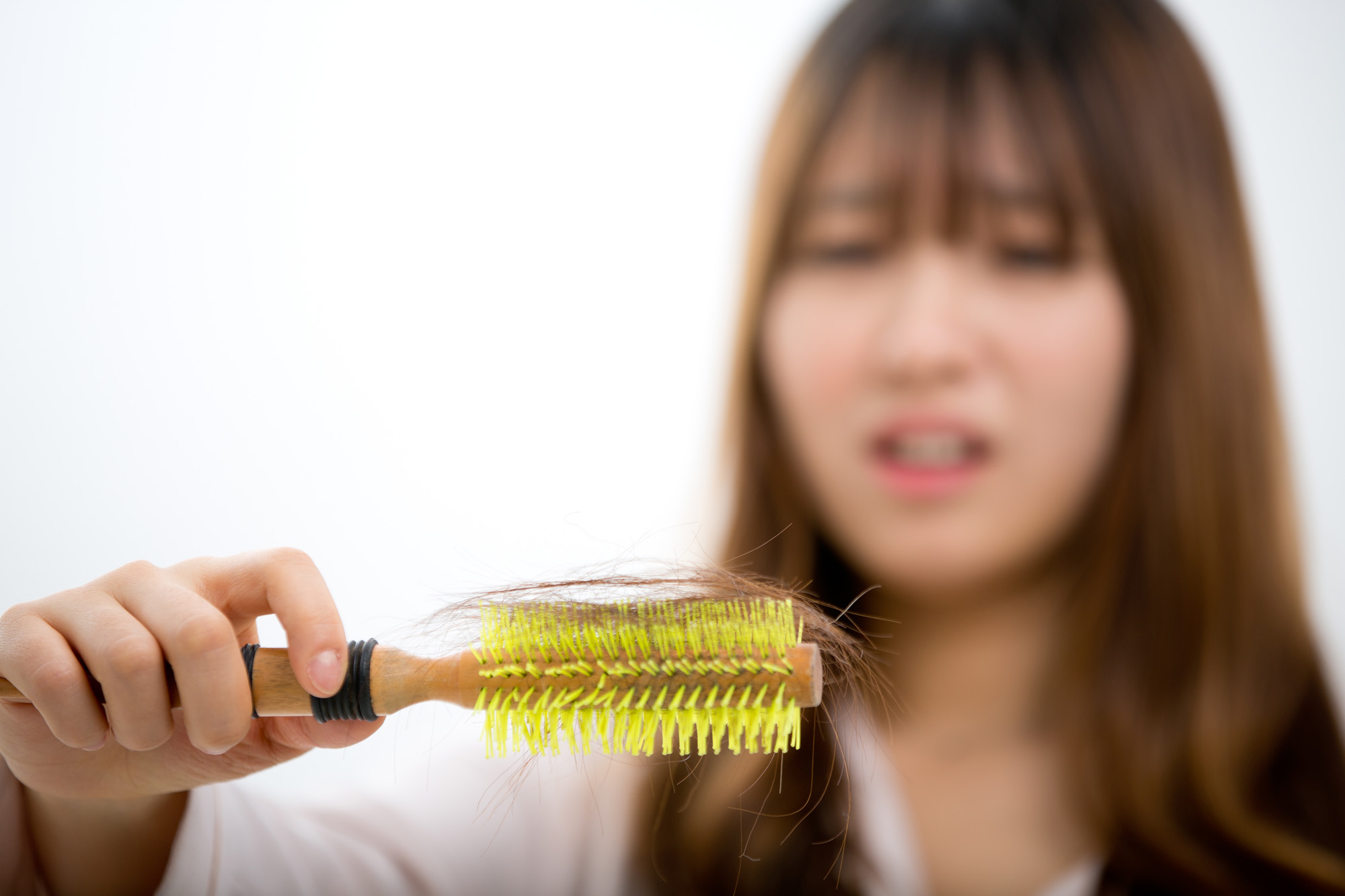 탈모;여성탈모;20대탈모;청년탈모