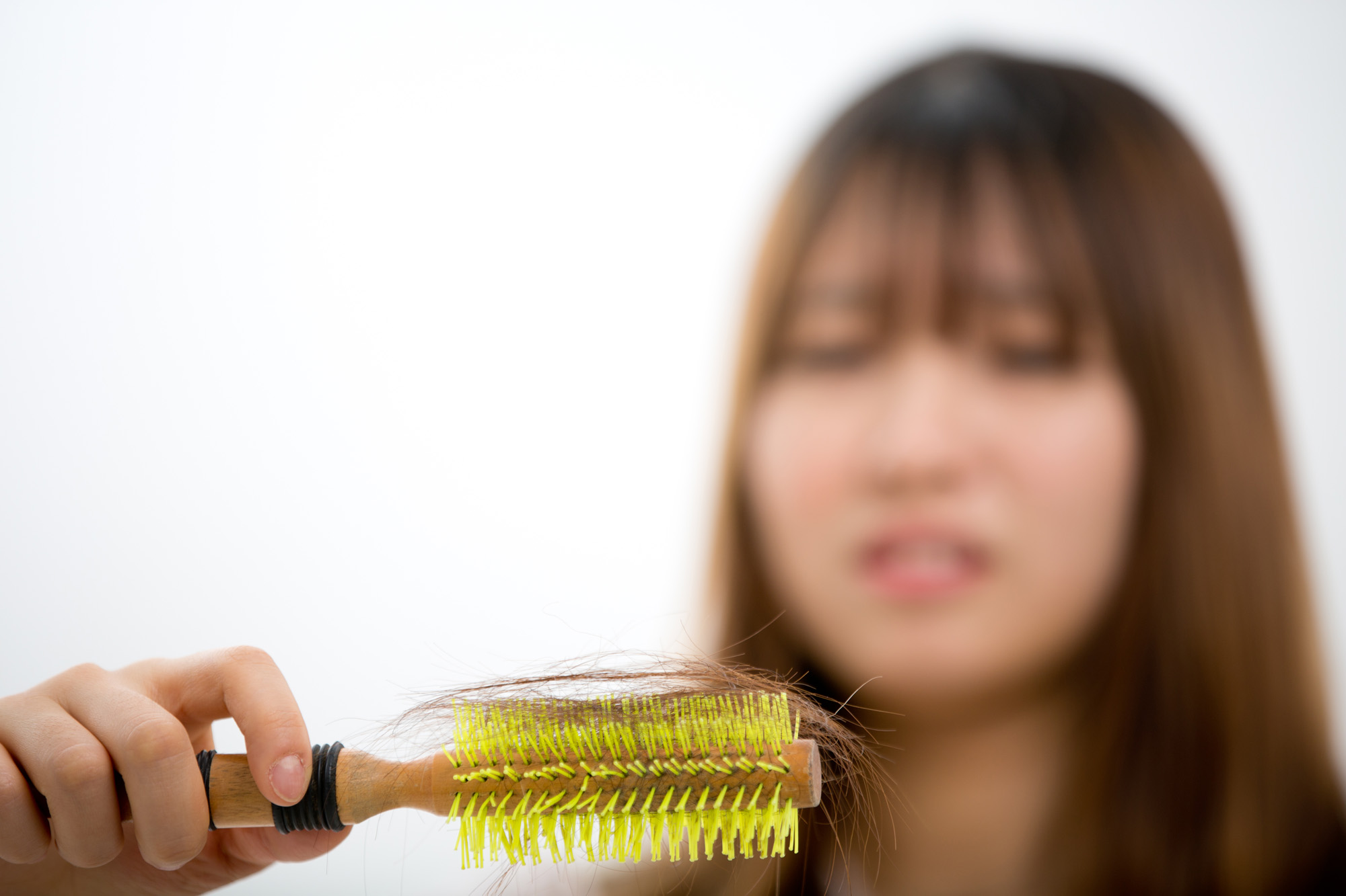 탈모;여성탈모;20대탈모;청년탈모