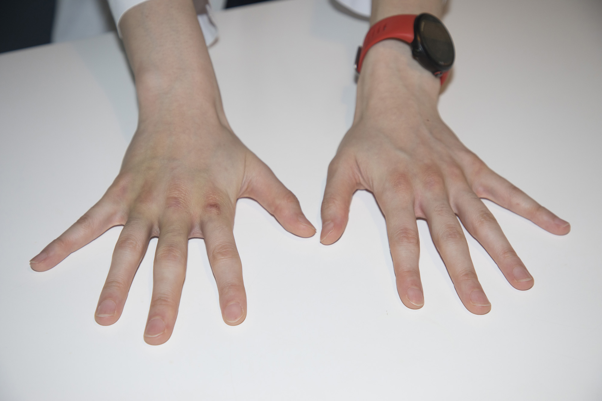 사회;세태;의사;순천향대학병원;권투;복싱;한국챔피언